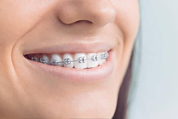 Best Invisalign and Clear Aligners  in Owings Mills, MD